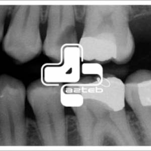 رادیولوژی دندان (2)